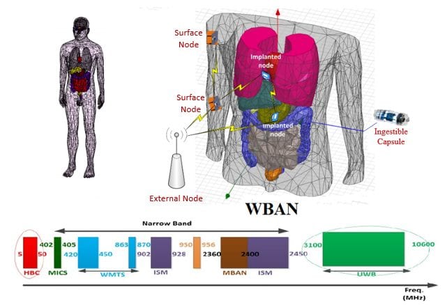 PDF) Wireless Body Sensor Communication Systems Based on UWB and